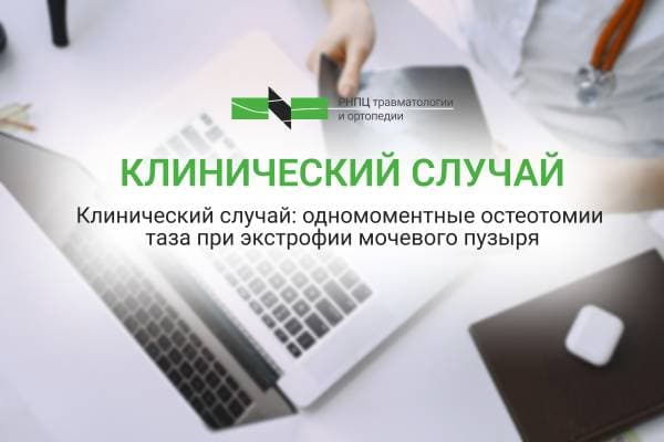 Клинический случай: одномоментные остеотомии таза при экстрофии мочевого пузыря